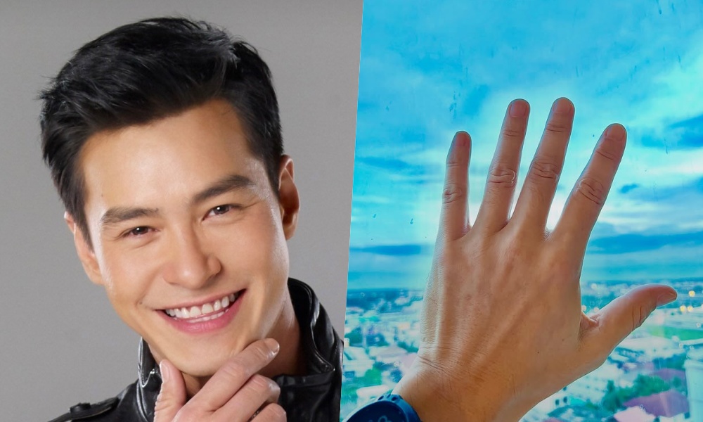 ช็อกวงการ! “ปีเตอร์ คอร์ป” โพสต์ภาพถอดแหวนแต่งงาน เผยถอดมาสักพักใหญ่แล้ว